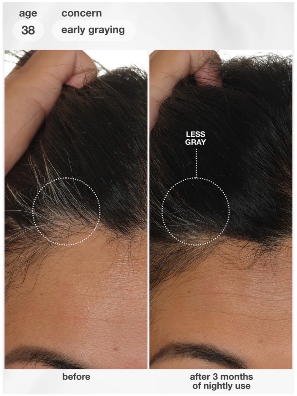 K18 FutureIQ Biomimetic Hair Serum - Picture 4 of 8